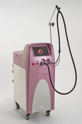 Vbeam II with Fiber